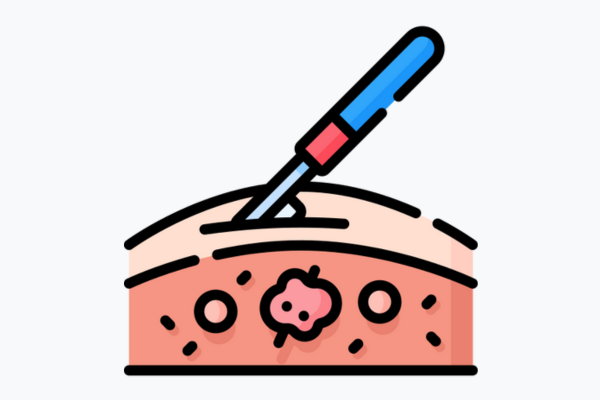 Department of General & Laparoscopic Surgery